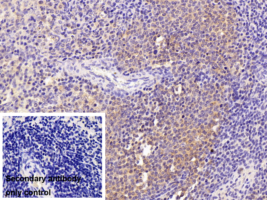 Polyclonal Antibody to Cluster Of Differentiation 5 (CD5)