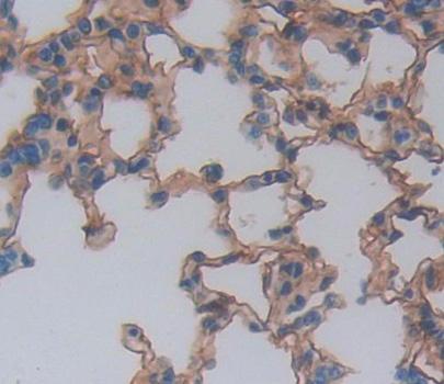 Polyclonal Antibody to Natural Cytotoxicity Triggering Receptor 1 (NCR1)