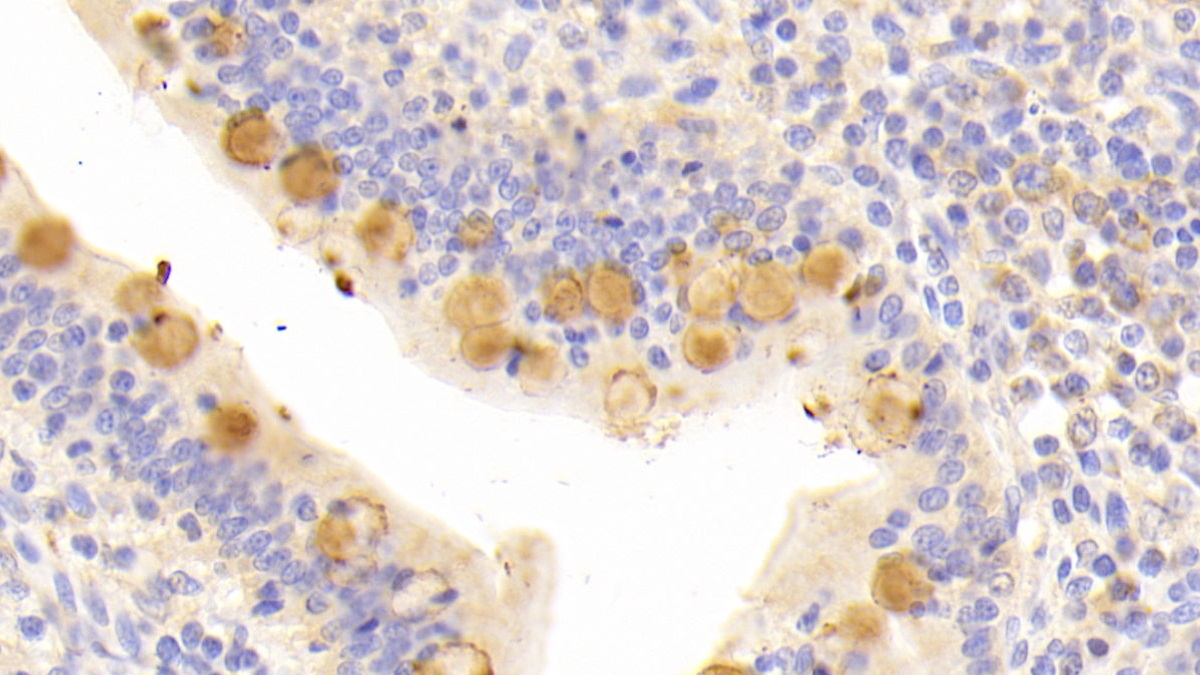 Polyclonal Antibody to High Molecular Weight Kininogen (HMWK)