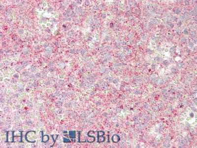 Polyclonal Antibody to Jagged 1 (JAG1)