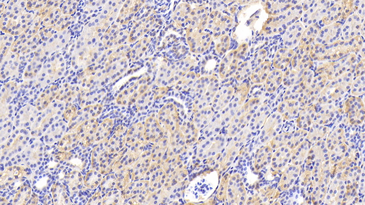 Polyclonal Antibody to Vitamin D Binding Protein (DBP)