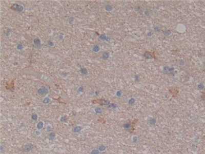 Polyclonal Antibody to Nuclear Factor Kappa B (NFkB)