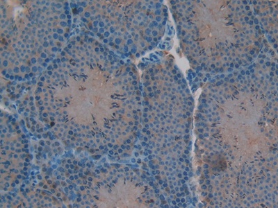 Polyclonal Antibody to V-Rel Reticuloendotheliosis Viral Oncogene Homolog B (RELB)