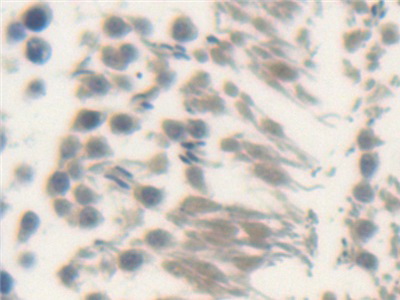 Polyclonal Antibody to Hedgehog Homolog, Sonic (SHH)