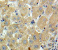 Polyclonal Antibody to Coagulation Factor XI (F11)