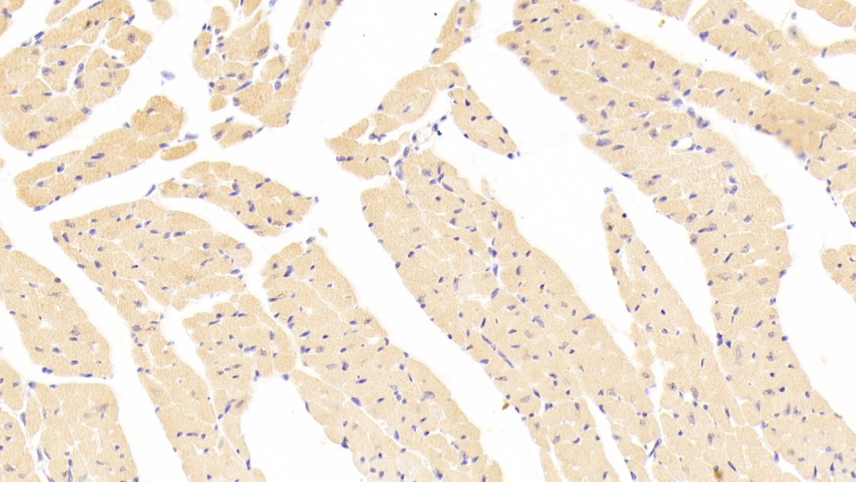 Polyclonal Antibody to Vinculin (VCL)