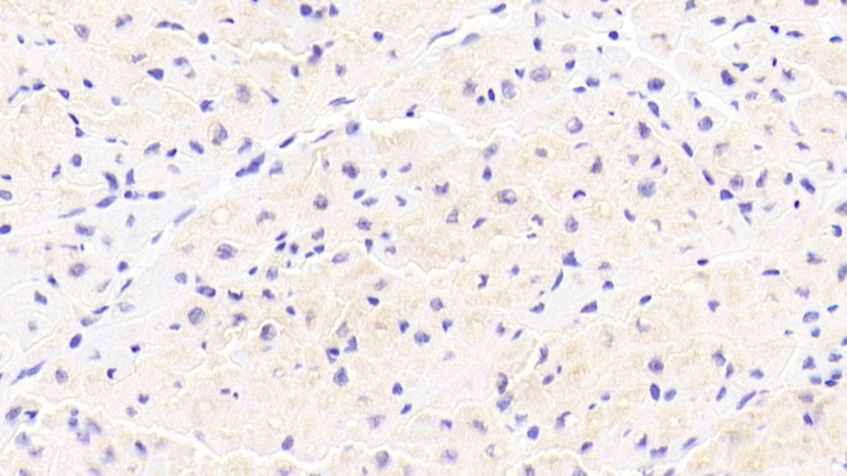 Polyclonal Antibody to Inhibitory Subunit Of NF Kappa B Alpha (IkBa)