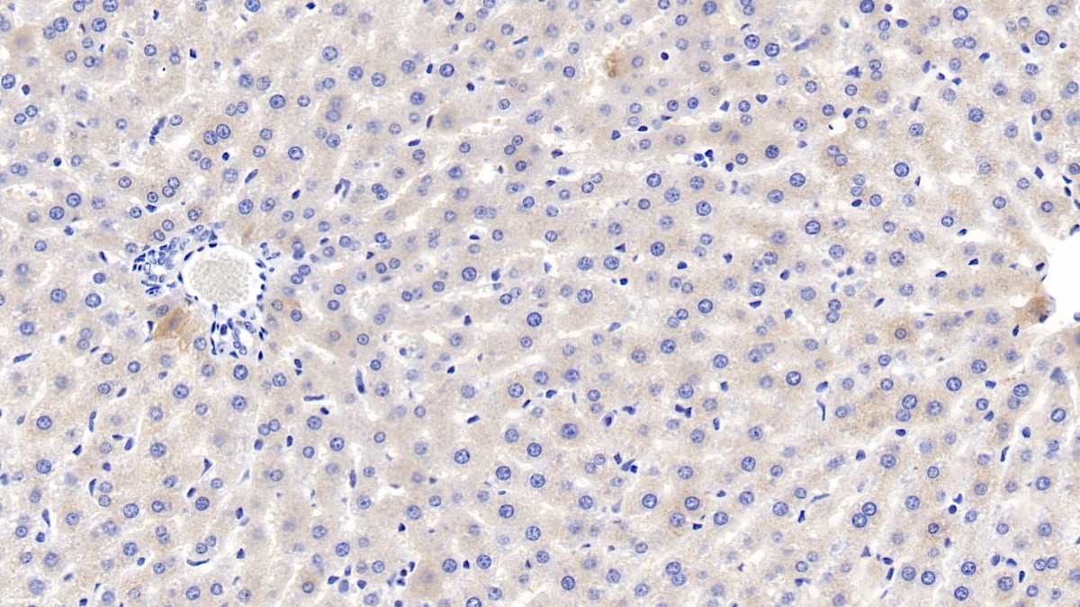 Polyclonal Antibody to Fetuin B (FETUB)