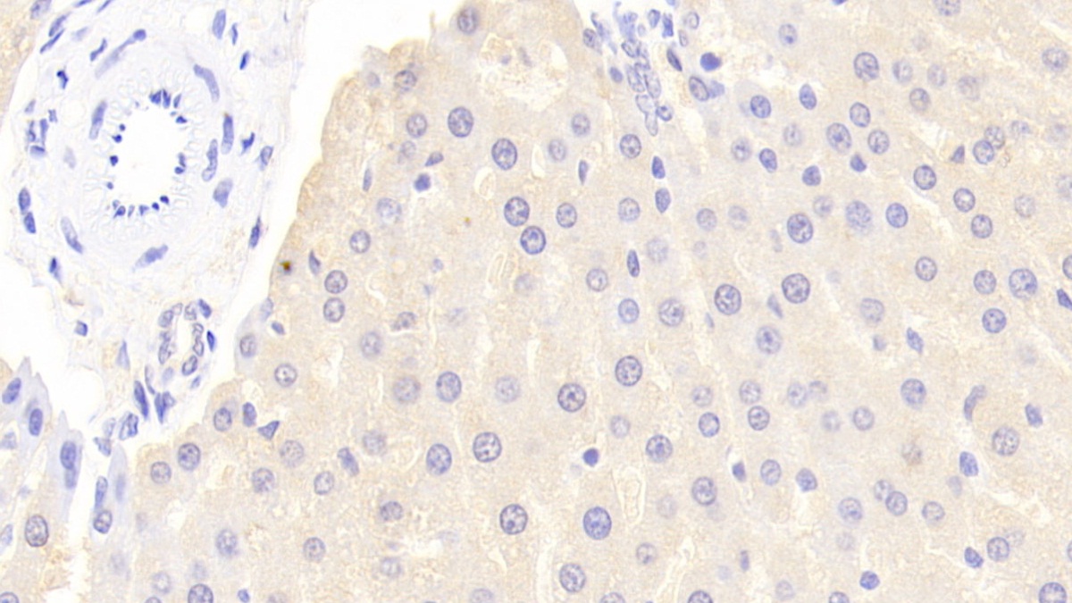 Polyclonal Antibody to Fetuin B (FETUB)