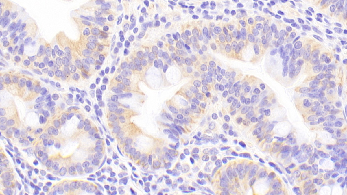 Polyclonal Antibody to Metallothionein 2 (MT2)