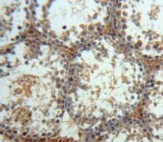 Polyclonal Antibody to Mitogen Activated Protein Kinase 10 (MAPK10)
