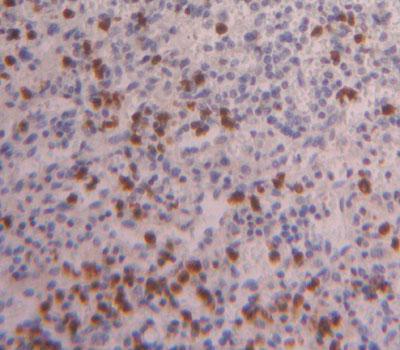 Polyclonal Antibody to Forkhead Box P3 (FOXP3)