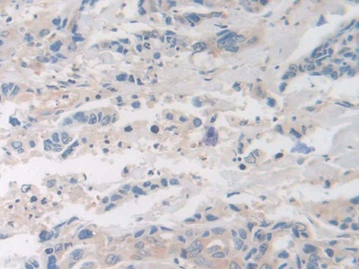 Polyclonal Antibody to Coagulation Factor VIII (F8)