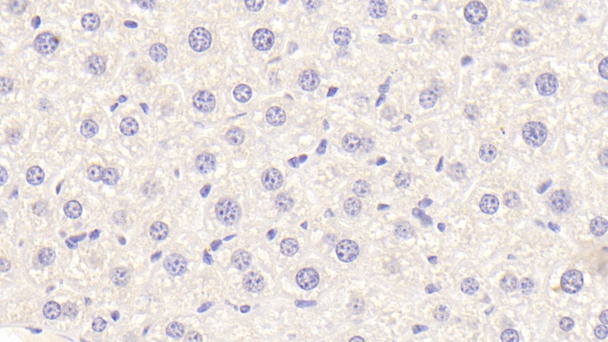 Polyclonal Antibody to Apolipoprotein F (APOF)