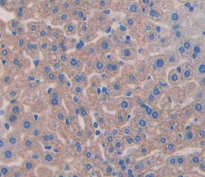 Polyclonal Antibody to Aggrecan (AGC)