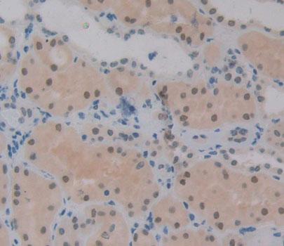 Polyclonal Antibody to Phosphatidylserine Receptor (PSR)