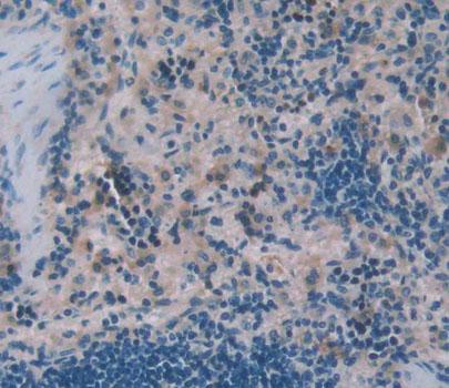 Polyclonal Antibody to Wiskott Aldrich Syndrome Protein (WASP)