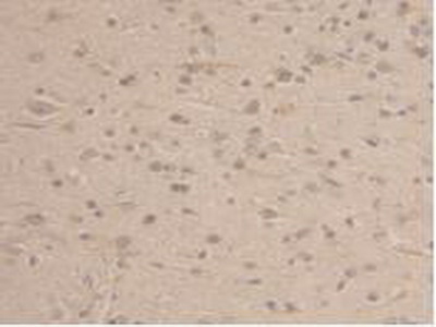 Polyclonal Antibody to Glyceraldehyde-3-Phosphate Dehydrogenase (GAPDH)