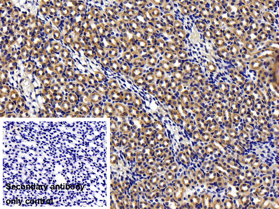 Polyclonal Antibody to Cathepsin S (CTSS)