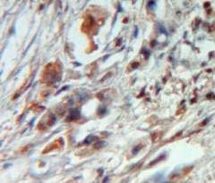 Polyclonal Antibody to Syndecan 4 (SDC4)