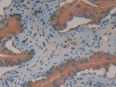 Polyclonal Antibody to Annexin A2 (ANXA2)