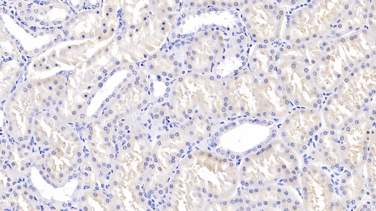 Polyclonal Antibody to Transforming Growth Factor Beta 3 (TGFb3)