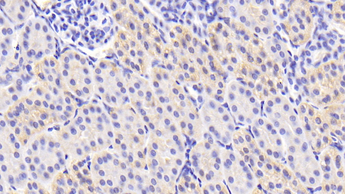 Polyclonal Antibody to Transforming Growth Factor Beta 3 (TGFb3)