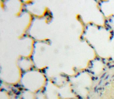 Polyclonal Antibody to Toll Like Receptor 7 (TLR7)