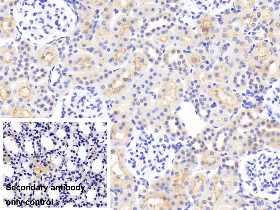 Polyclonal Antibody to Monoamine Oxidase A (MAOA)