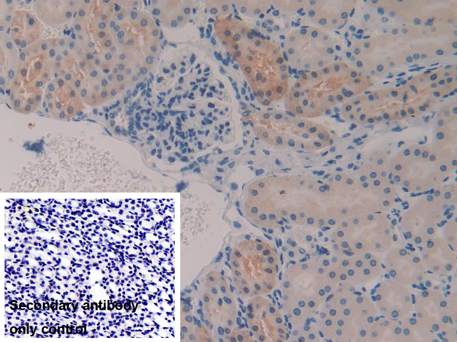 Polyclonal Antibody to Glutathione S Transferase Alpha 2 (GSTa2)