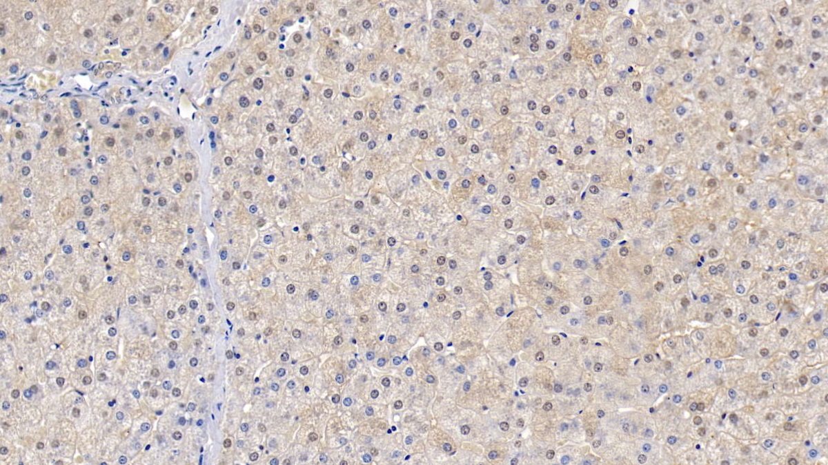 Polyclonal Antibody to Superoxide Dismutase 1 (SOD1)