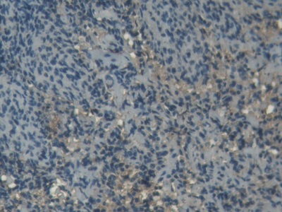 Polyclonal Antibody to Superoxide Dismutase 1 (SOD1)