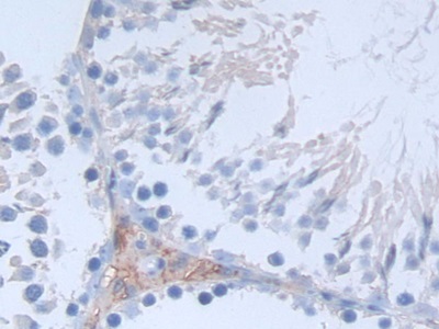 Polyclonal Antibody to Syndecan 1 (SDC1)