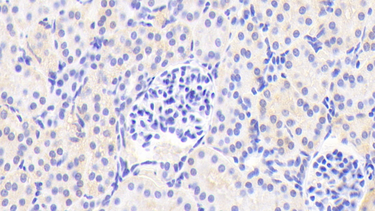 Polyclonal Antibody to Apolipoprotein D (APOD)