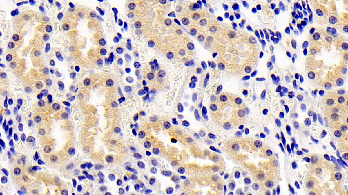 Polyclonal Antibody to Apolipoprotein D (APOD)