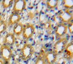 Polyclonal Antibody to A Disintegrin And Metalloproteinase With Thrombospondin 1 (ADAMTS1)