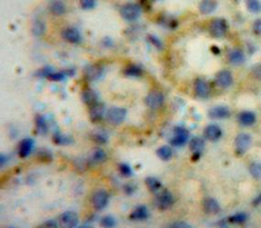 Polyclonal Antibody to A Disintegrin And Metalloproteinase With Thrombospondin 1 (ADAMTS1)