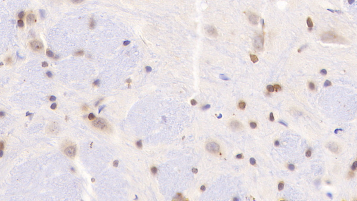 Polyclonal Antibody to A Disintegrin And Metalloproteinase With Thrombospondin 7 (ADAMTS7)