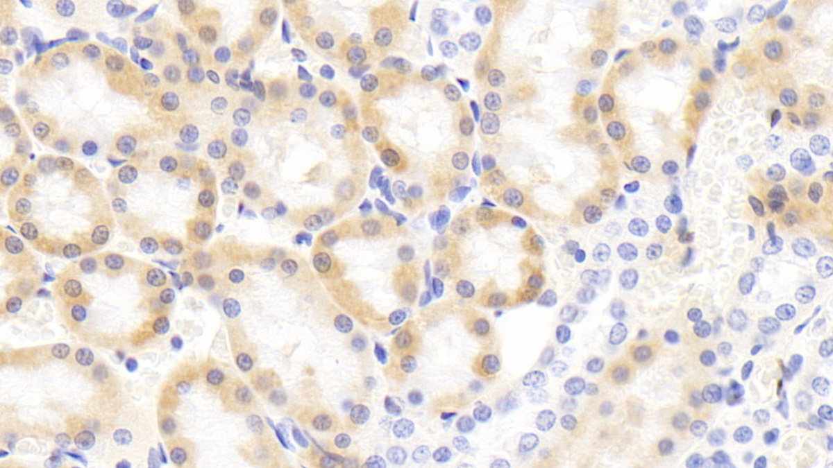 Polyclonal Antibody to Fatty Acid Binding Protein 5 (FABP5)