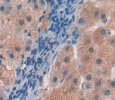 Polyclonal Antibody to Hemopexin (HPX)