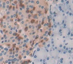 Polyclonal Antibody to Arrestin Beta 2 (ARRb2)