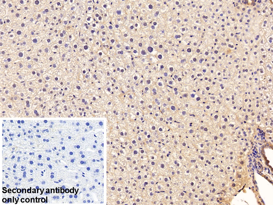 Polyclonal Antibody to Serpin A10 (SERPINA10)