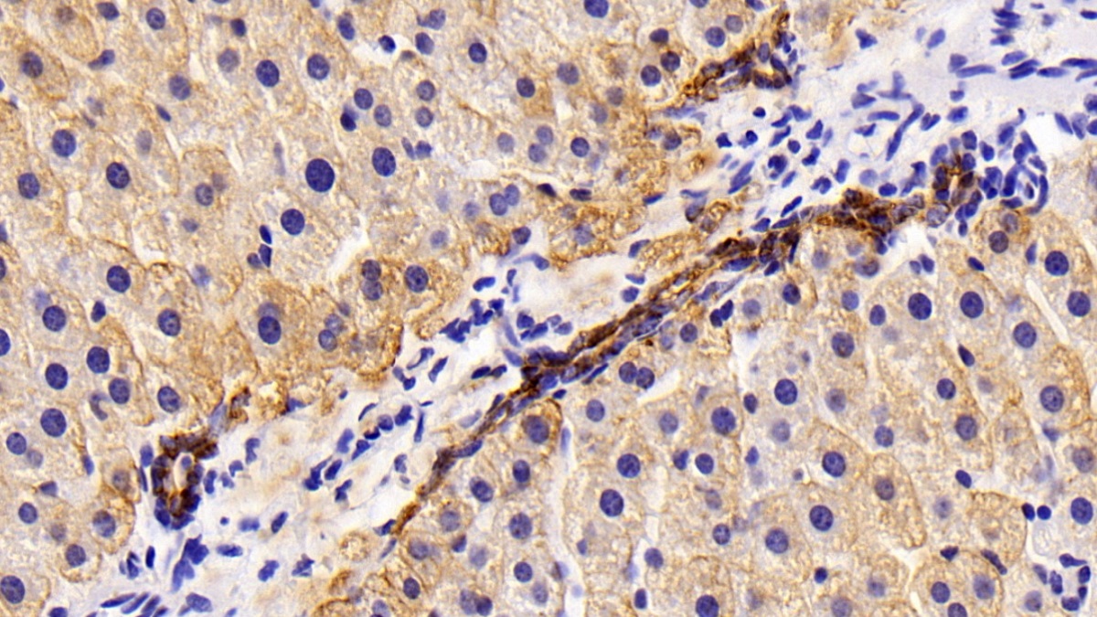 Polyclonal Antibody to Cytokeratin 8 (CK8)