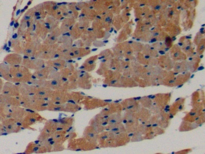 Polyclonal Antibody to Creatine Kinase B (CK-BB)