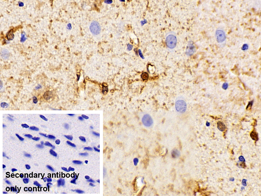 Polyclonal Antibody to Creatine Kinase B (CK-BB)