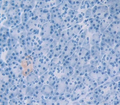 Polyclonal Antibody to Growth Differentiation Factor 15 (GDF15)