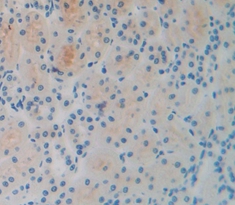 Polyclonal Antibody to Growth Differentiation Factor 15 (GDF15)