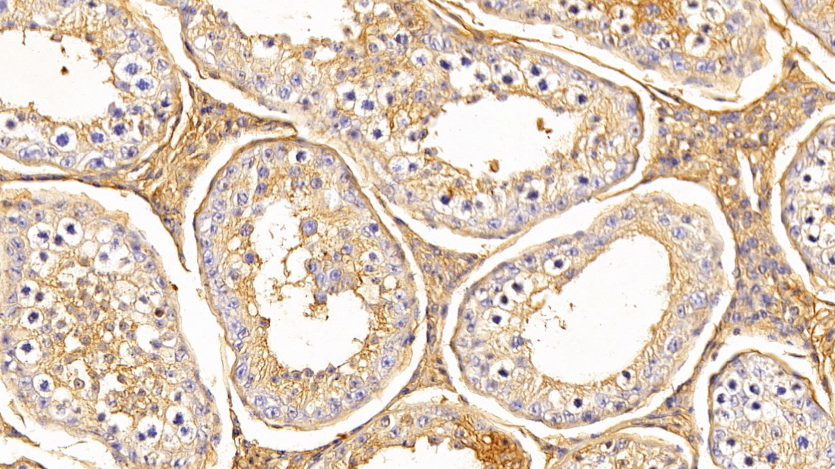 Polyclonal Antibody to Transferrin (TF)