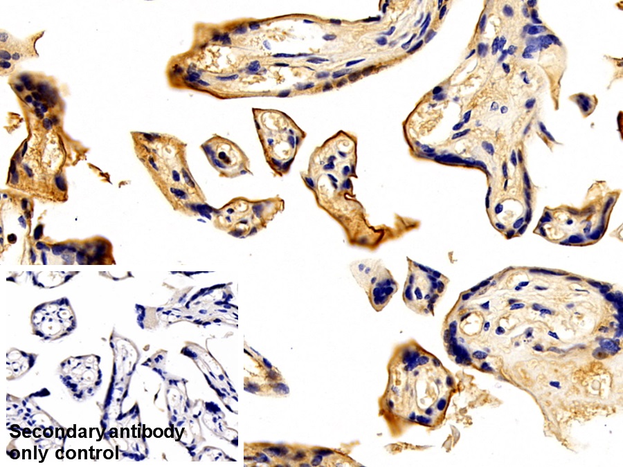 Polyclonal Antibody to Transferrin (TF)