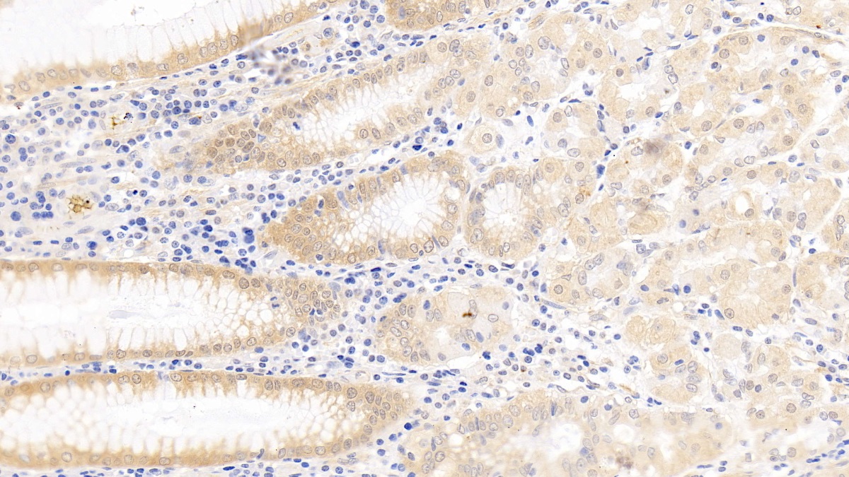 Polyclonal Antibody to Survivin (Surv)